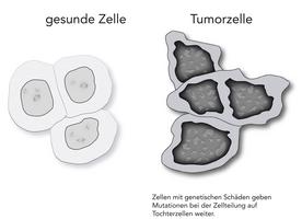 Krebszellen Krebszellen Micksche Reinzeichnung